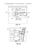 Portable Dialysis Machine diagram and image