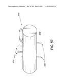 Portable Dialysis Machine diagram and image