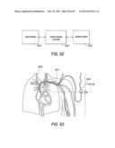 Portable Dialysis Machine diagram and image