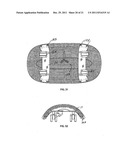 Footrest diagram and image