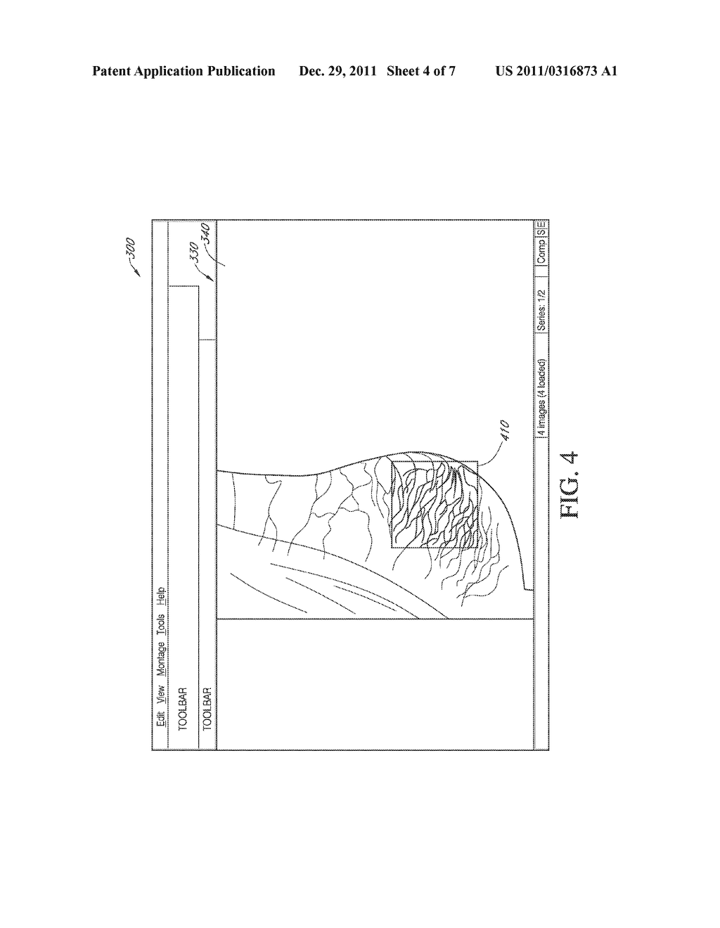 SYSTEMS AND METHODS FOR VIEWING MEDICAL IMAGES - diagram, schematic, and image 05