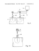 Resistance Temperature Sensor diagram and image