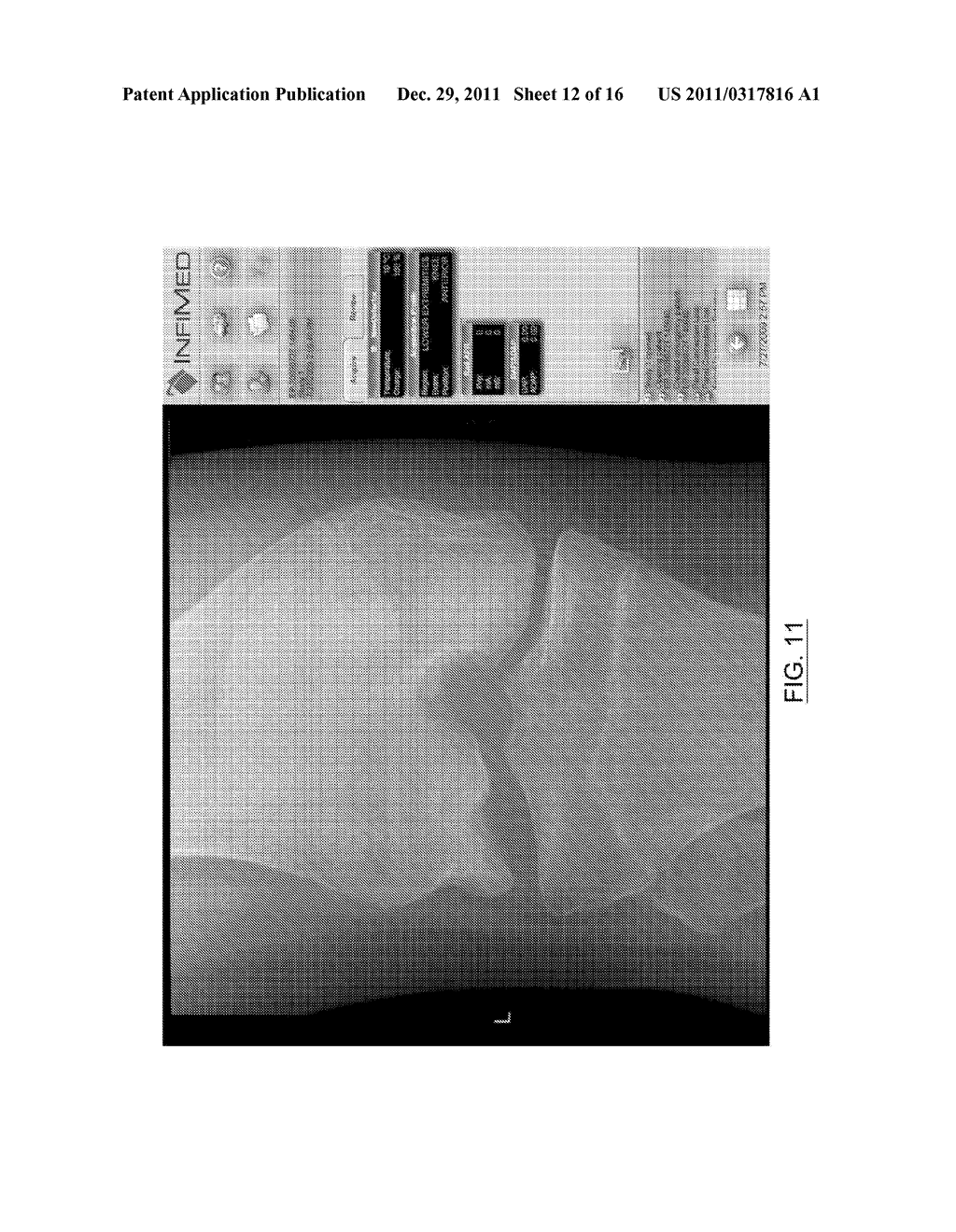 Conversion of Existing Portable or Mobile Analog Radiographic Apparatus     for Enabling Digital Radiographic Applications - diagram, schematic, and image 13