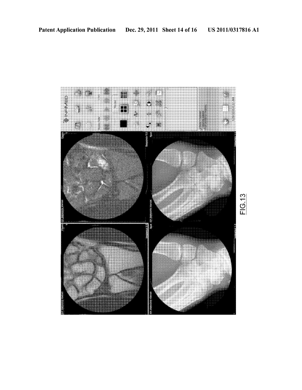 Conversion of Existing Portable or Mobile Analog Radiographic Apparatus     for Enabling Digital Radiographic Applications - diagram, schematic, and image 15