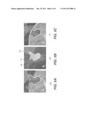 LIVER LESION SEGMENTATION diagram and image