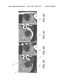 LIVER LESION SEGMENTATION diagram and image