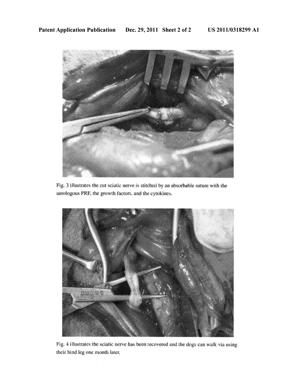 Composition for Accelerating Nerve Repair - diagram, schematic, and image 03