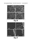 METHODS AND COMPOSITIONS FOR CNS DELIVERY OF B-GALACTOCEREBROSIDASE diagram and image