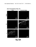 METHODS AND COMPOSITIONS FOR CNS DELIVERY OF B-GALACTOCEREBROSIDASE diagram and image