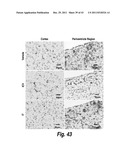 METHODS AND COMPOSITIONS FOR CNS DELIVERY OF B-GALACTOCEREBROSIDASE diagram and image