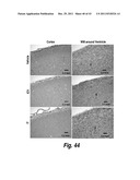 METHODS AND COMPOSITIONS FOR CNS DELIVERY OF B-GALACTOCEREBROSIDASE diagram and image