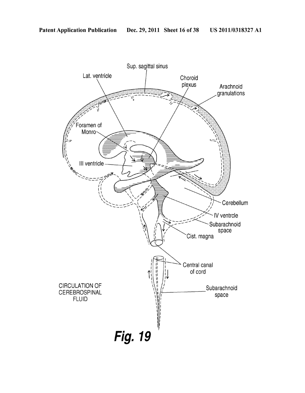 TREATMENT OF SANFILIPPO SYNDROME TYPE B - diagram, schematic, and image 17