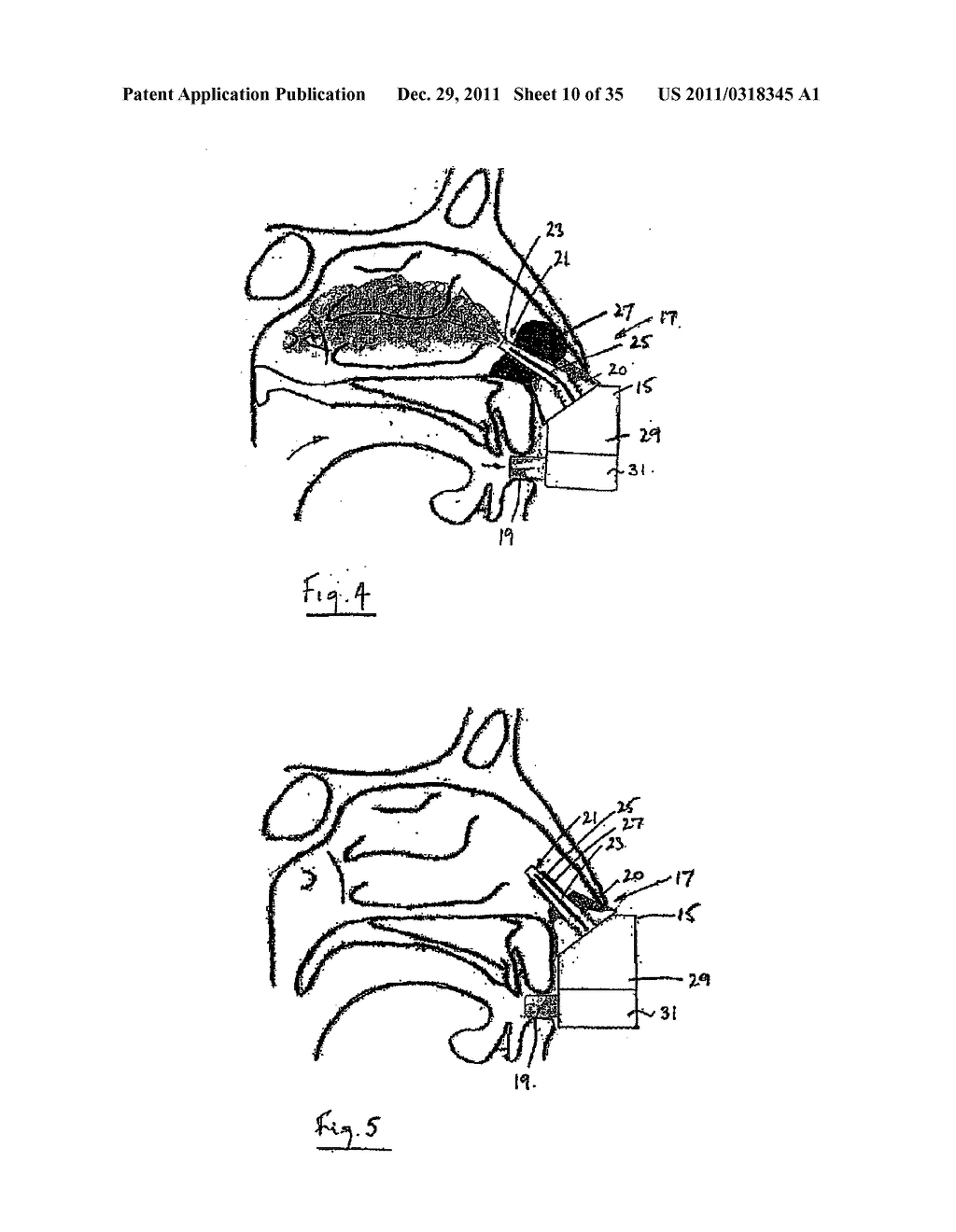 NASAL DELIVERY - diagram, schematic, and image 11