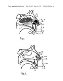 NASAL DELIVERY diagram and image