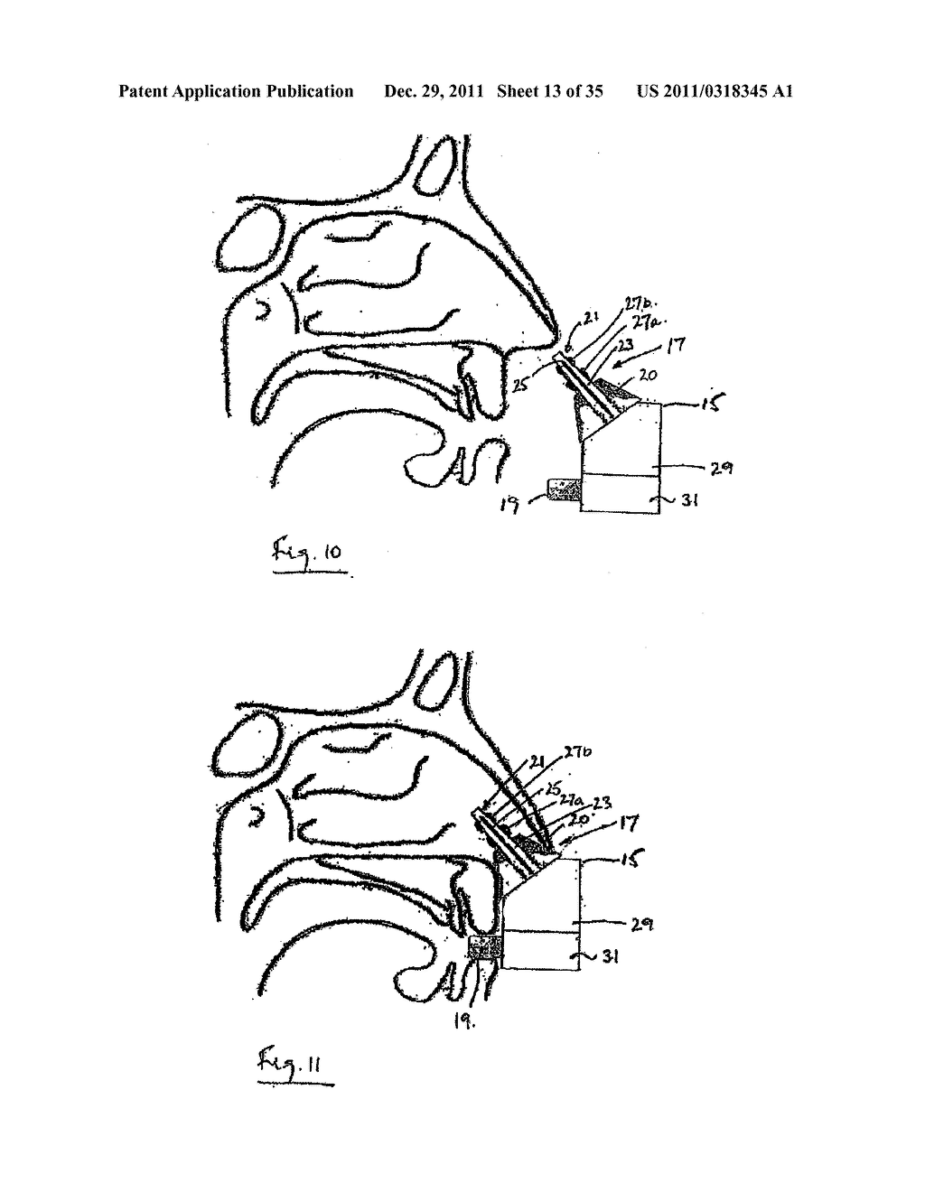 NASAL DELIVERY - diagram, schematic, and image 14