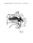 NASAL DELIVERY diagram and image