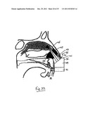 NASAL DELIVERY diagram and image