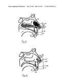 NASAL DELIVERY diagram and image