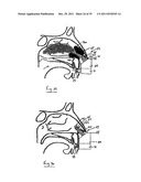 NASAL DELIVERY diagram and image