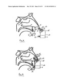 NASAL DELIVERY diagram and image