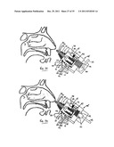 NASAL DELIVERY diagram and image