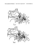 NASAL DELIVERY diagram and image