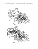 NASAL DELIVERY diagram and image