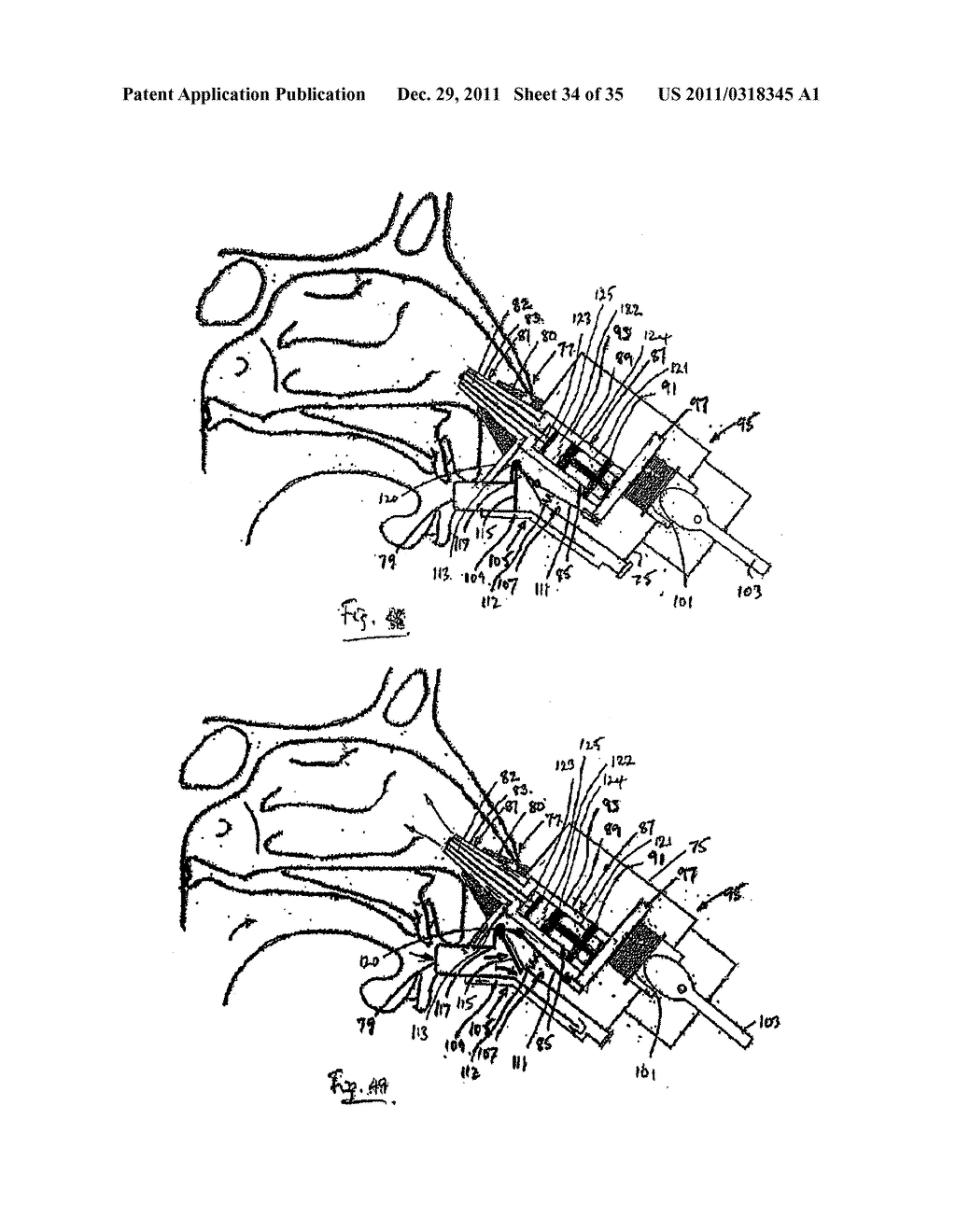 NASAL DELIVERY - diagram, schematic, and image 35