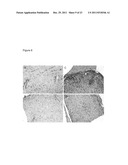 Alpha B-crystallin as a therapy for Ischemia or inflammation diagram and image