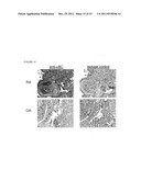 Alpha B-crystallin as a therapy for Ischemia or inflammation diagram and image