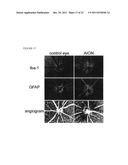 Alpha B-crystallin as a therapy for Ischemia or inflammation diagram and image