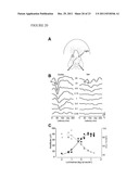 Alpha B-crystallin as a therapy for Ischemia or inflammation diagram and image