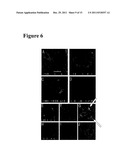 METHODS AND COMPOSITIONS BASED ON SHIGA TOXIN TYPE 2 PROTEIN diagram and image