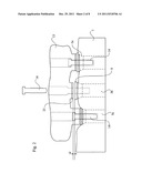  DENTAL IMPLANT, A DENTAL IMPLANT KIT AND A METHOD OF SECURING A DENTAL     BRIDGE TO THE JAW OF THE PATIENT diagram and image