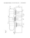  DENTAL IMPLANT, A DENTAL IMPLANT KIT AND A METHOD OF SECURING A DENTAL     BRIDGE TO THE JAW OF THE PATIENT diagram and image