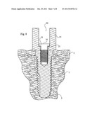  DENTAL IMPLANT, A DENTAL IMPLANT KIT AND A METHOD OF SECURING A DENTAL     BRIDGE TO THE JAW OF THE PATIENT diagram and image