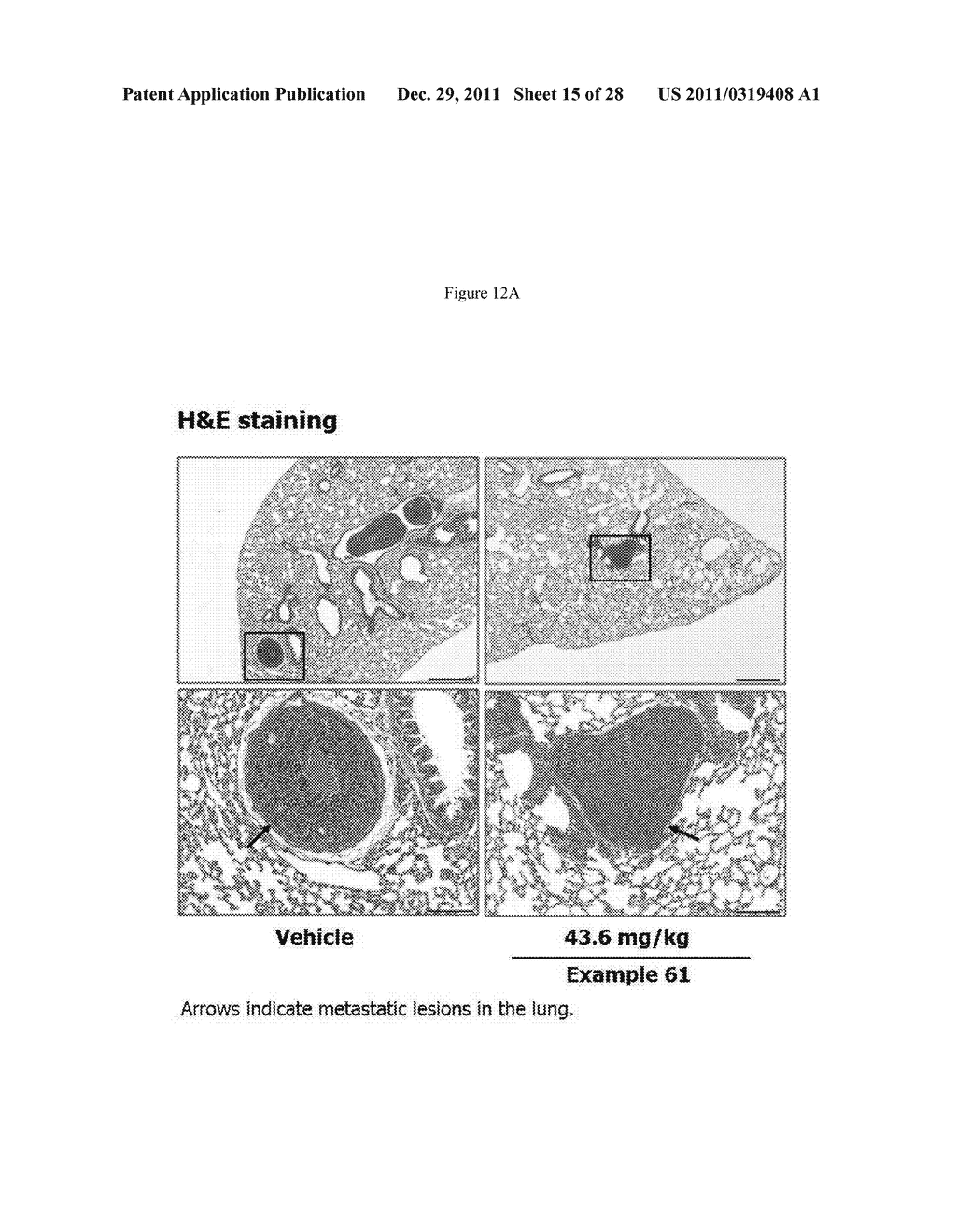 Methods of Treating Fibrosis, Cancer and Vascular Injuries - diagram, schematic, and image 16