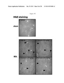 Methods of Treating Fibrosis, Cancer and Vascular Injuries diagram and image