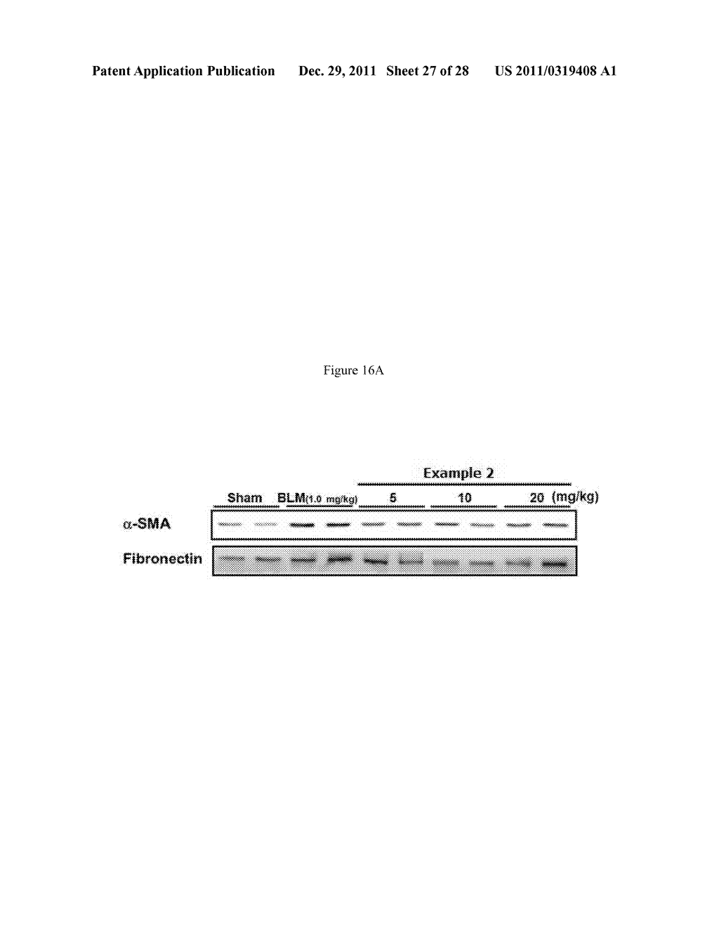 Methods of Treating Fibrosis, Cancer and Vascular Injuries - diagram, schematic, and image 28