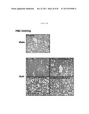 Methods of Treating Fibrosis, Cancer and Vascular Injuries diagram and image