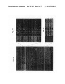 Diagnosis, prognosis and identification of potential therapeutic targets     of multiple myeloma based on gene expression profiling diagram and image