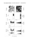 Diagnosis, prognosis and identification of potential therapeutic targets     of multiple myeloma based on gene expression profiling diagram and image