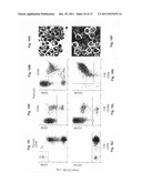 Diagnosis, prognosis and identification of potential therapeutic targets     of multiple myeloma based on gene expression profiling diagram and image