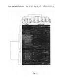 Diagnosis, prognosis and identification of potential therapeutic targets     of multiple myeloma based on gene expression profiling diagram and image