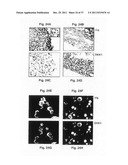 Diagnosis, prognosis and identification of potential therapeutic targets     of multiple myeloma based on gene expression profiling diagram and image