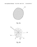 SURGICAL IMPLANT diagram and image