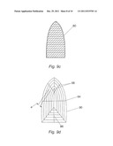 SURGICAL IMPLANT diagram and image