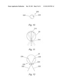 SURGICAL IMPLANT diagram and image