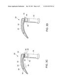 Laryngoscope diagram and image