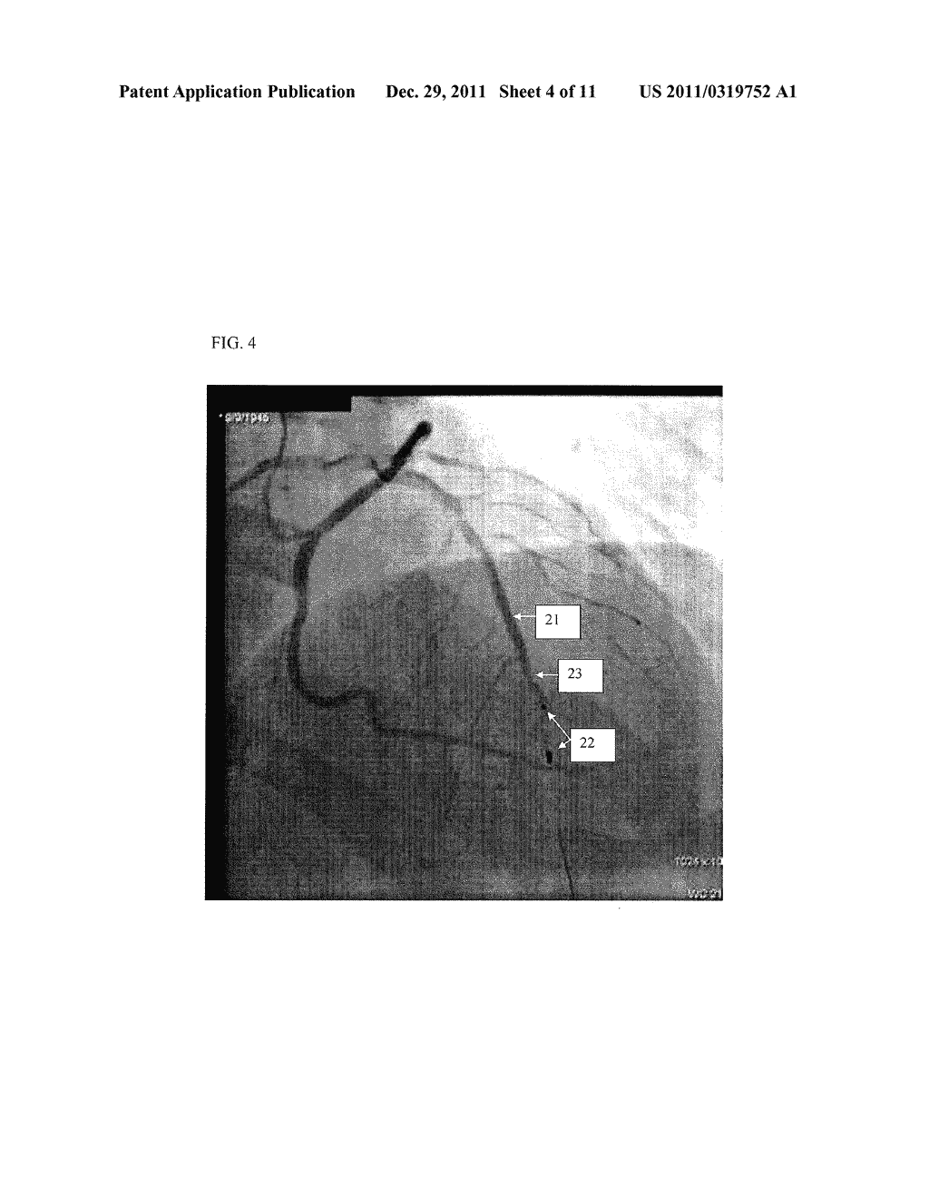 IMAGE SUPER ENHANCEMENT - diagram, schematic, and image 05